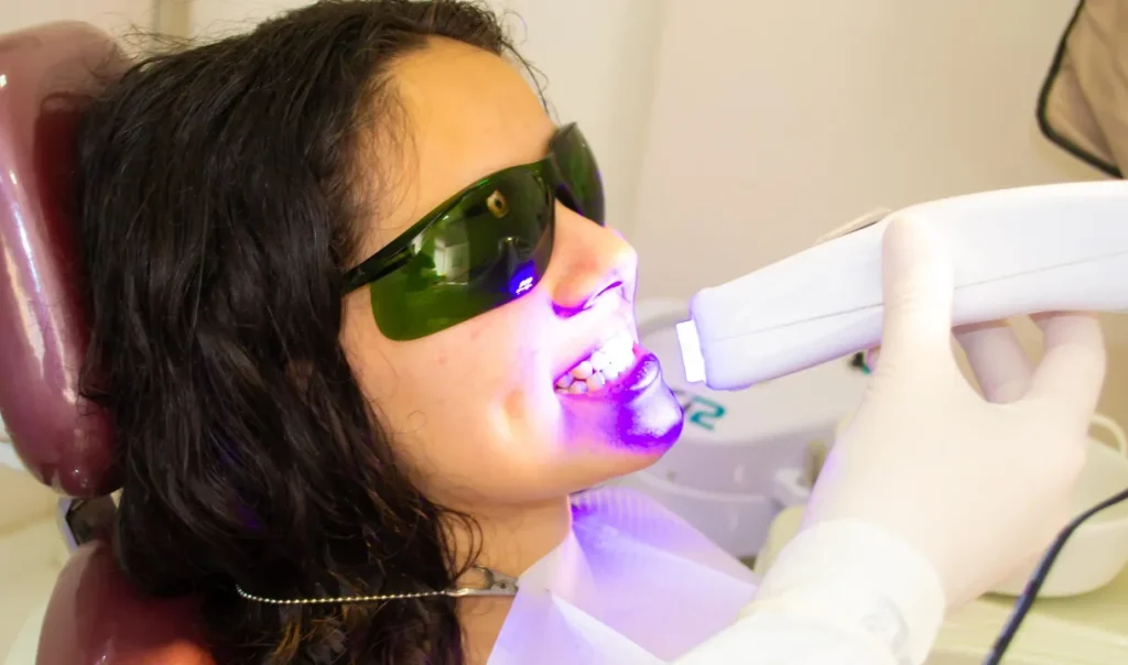 O Que É Clareamento Dental?