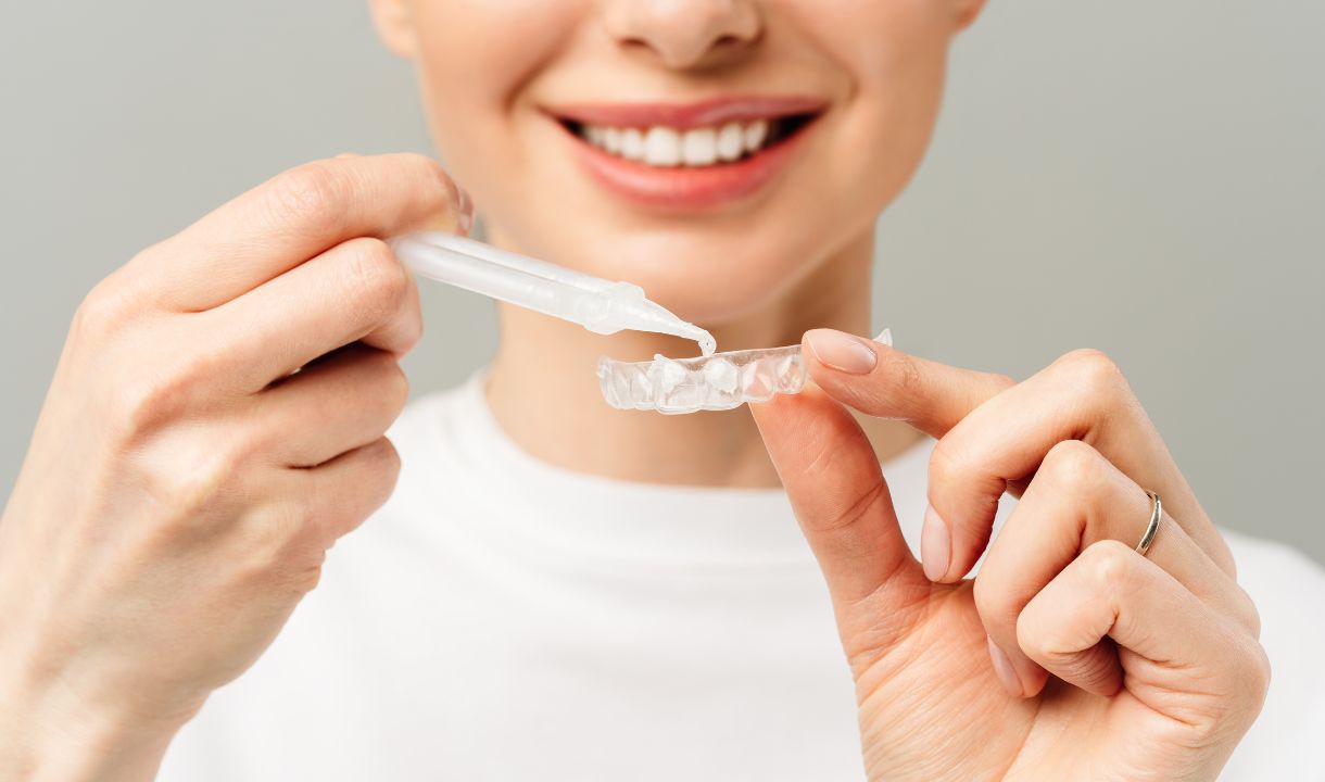 clareamento dental com moldeira