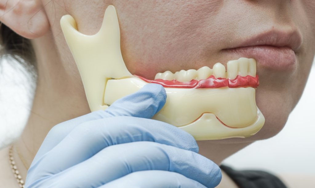 Articulação Temporomandibular