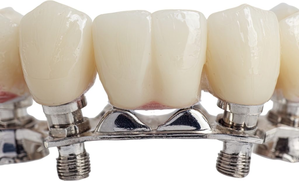 PROTESE DENTARIA (1)